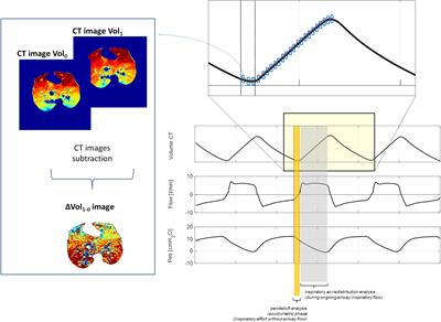 Inspiratory Efforts, Positive End-Expiratory Pressure, and External Resistances Influence Intraparenchymal Gas Redistribution in Mechanically Ventilated Injured Lungs